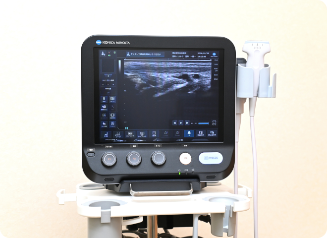 超音波診断機